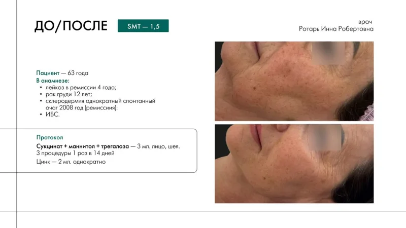 before/after